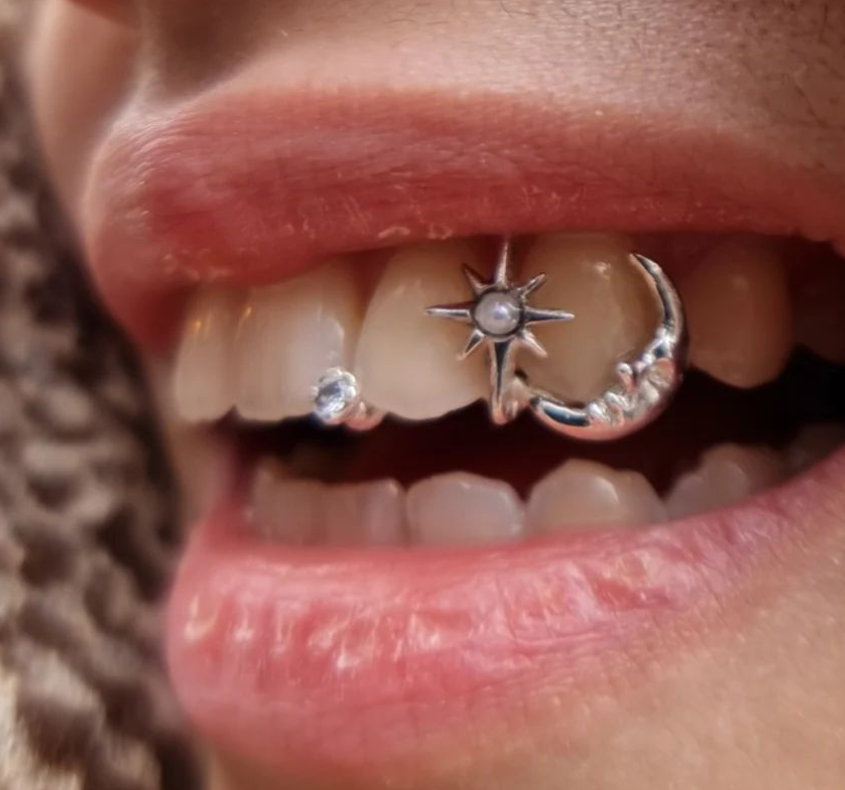 Moon & Twinkle Grillz